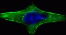 Approaches Single-Cell Analysis 2008